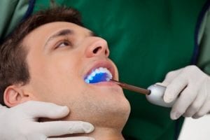 Is Dental Sealant Necessary | Dentist Gold Coast Parkwood