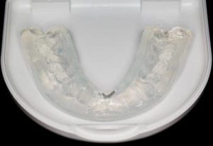 The Ultimate Guide for MouthGuards at Your Gold Coast Dentist