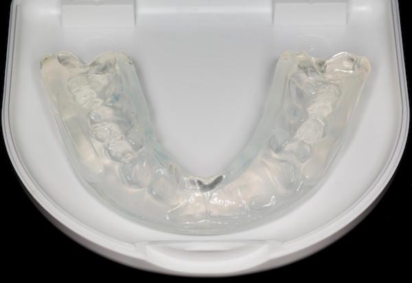 The Ultimate Guide for MouthGuards at Your Gold Coast Dentist