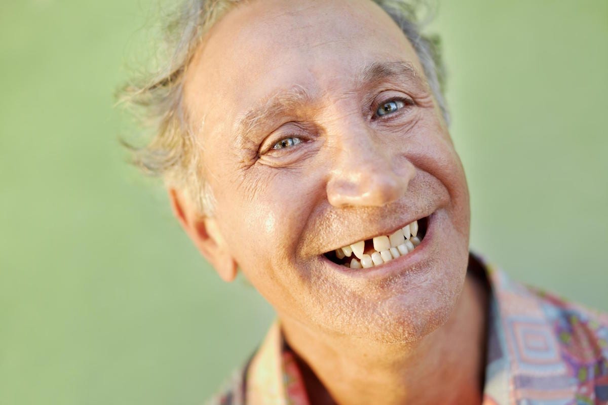 Top 4 Reasons Replacing Lost Teeth is Important