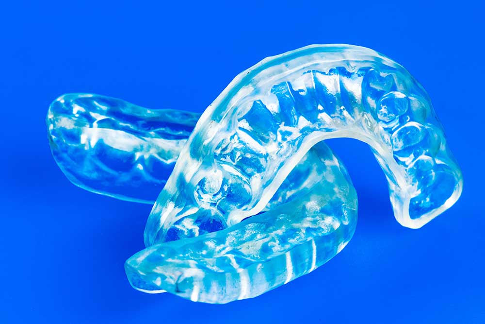 Mouthguards and Splints - Dental Clinic Parkwood